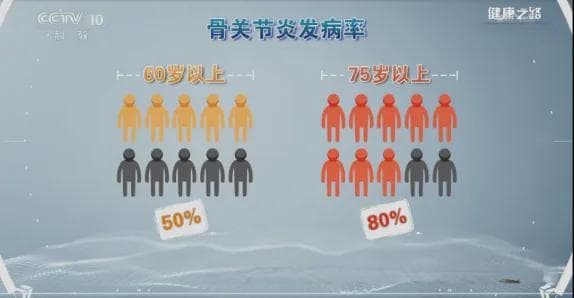 中国骨关节炎指南（2024版）：推荐早期及轻度阶段干细胞治疗
