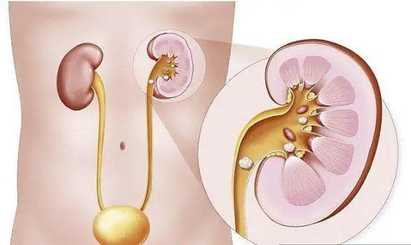 说这些人不能喝牛奶（不是乳糖不耐）？真的吗？