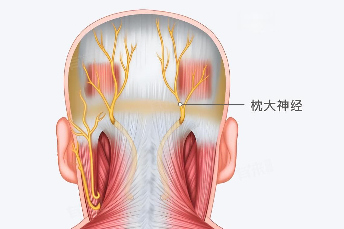 枕大神经位置示意图