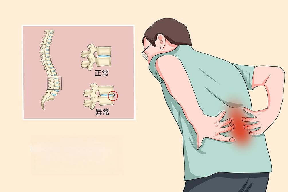 脊椎神经压迫挂什么科