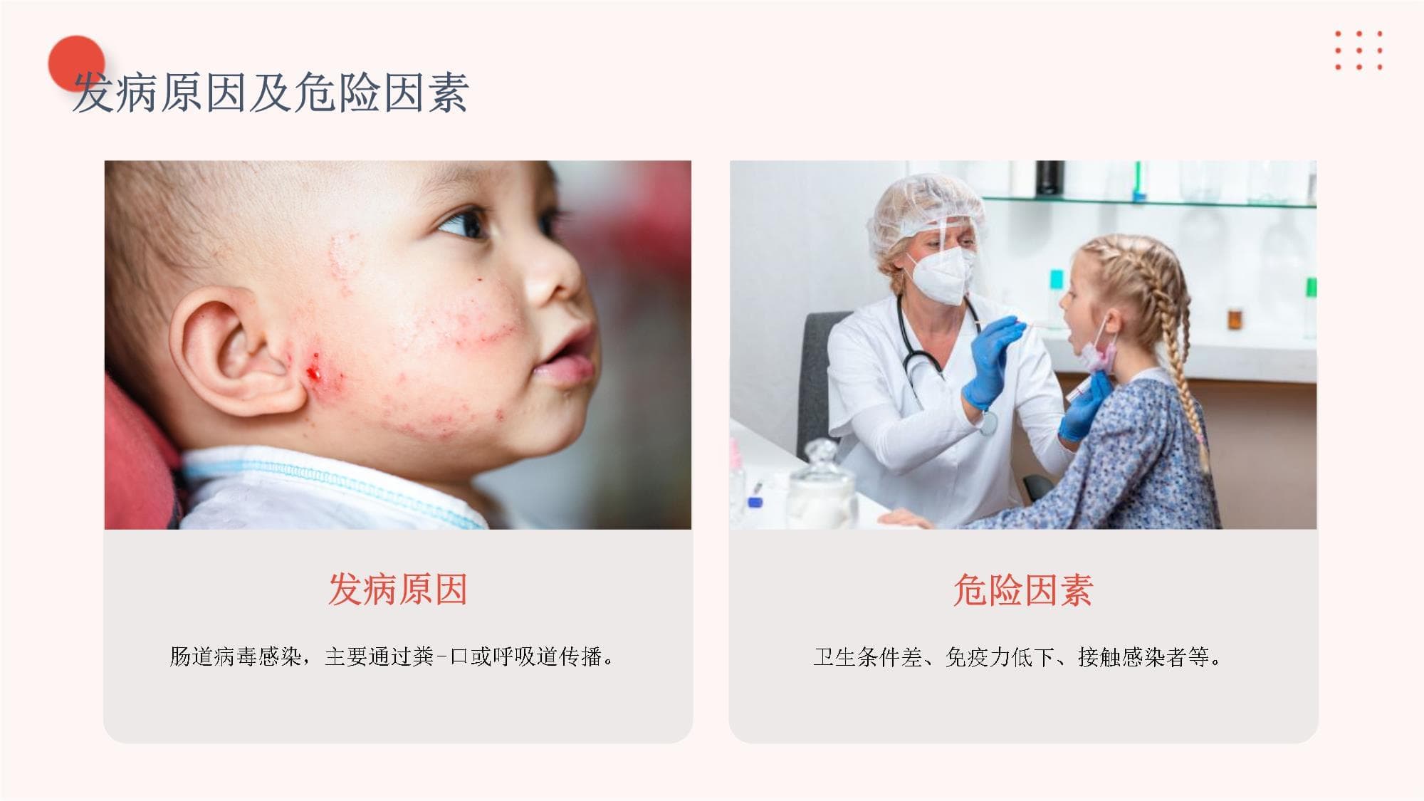 小儿疱疹性咽颊炎护理指南
