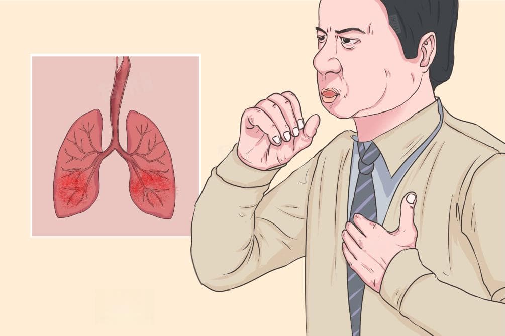 肺部炎症怎么才能彻底治好