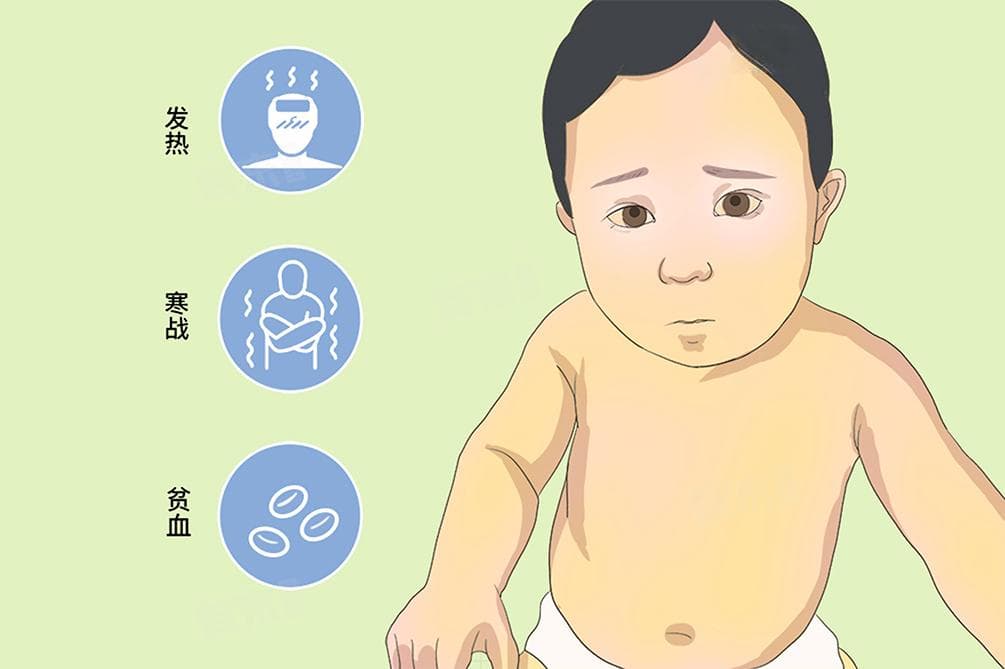 溶血性黄疸是怎么引起的