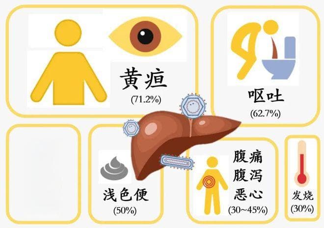 肝硬化早期的四个明显信号及应对之策