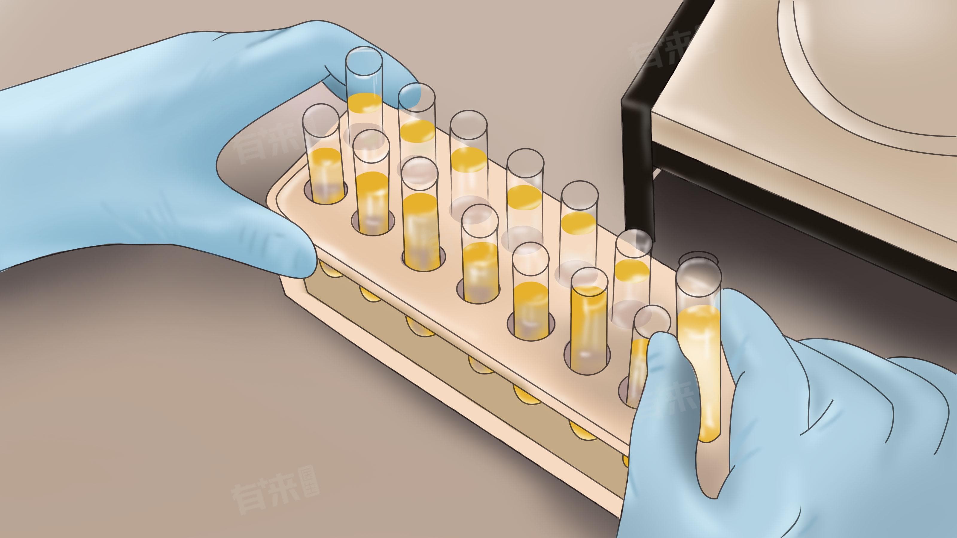 酮体弱阳性怎么办？原因分析与应对指南
