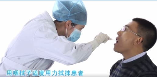 咽拭子样本采集流程和注意事项