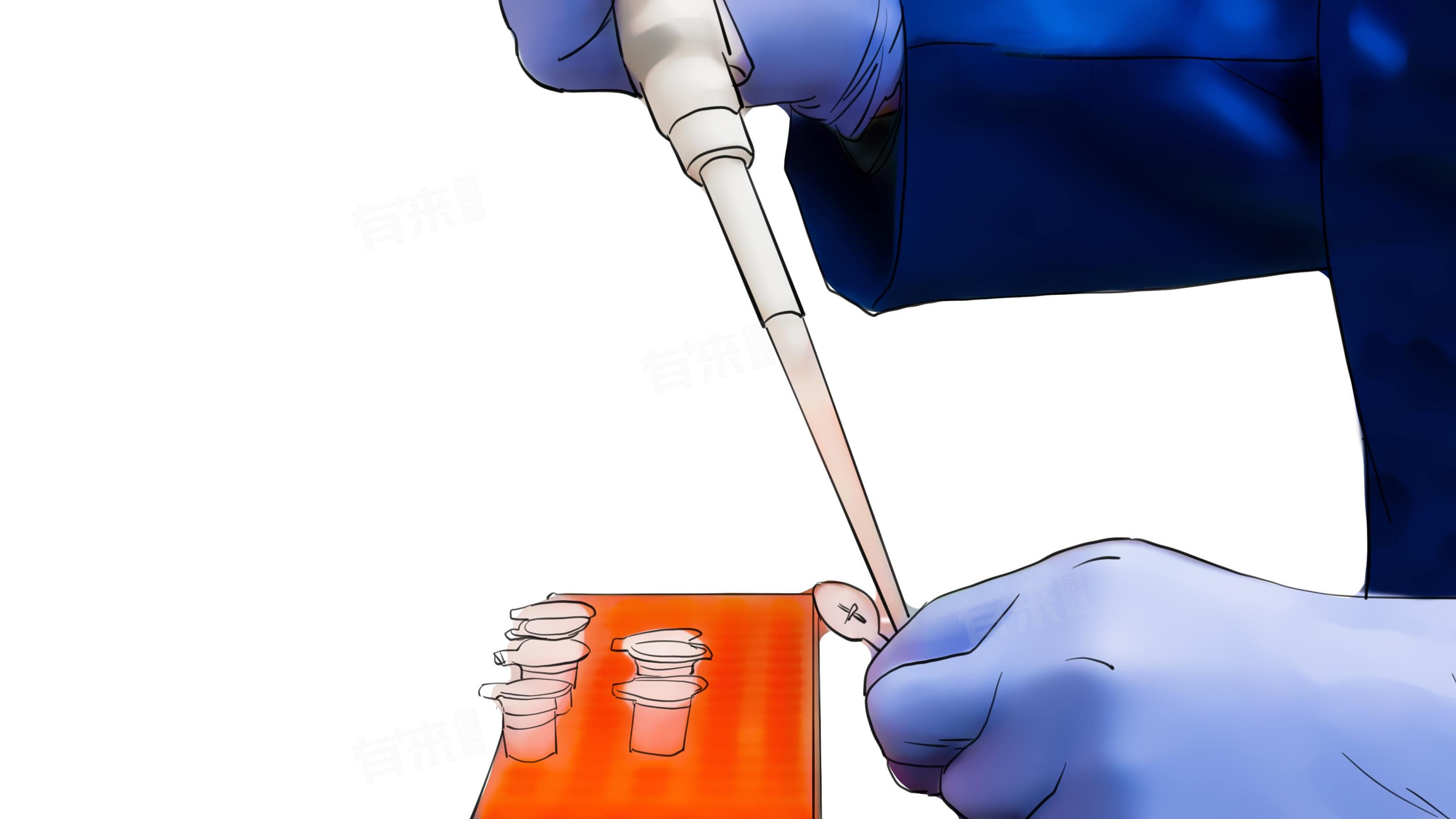 腰椎穿刺术操作流程及术后注意事项