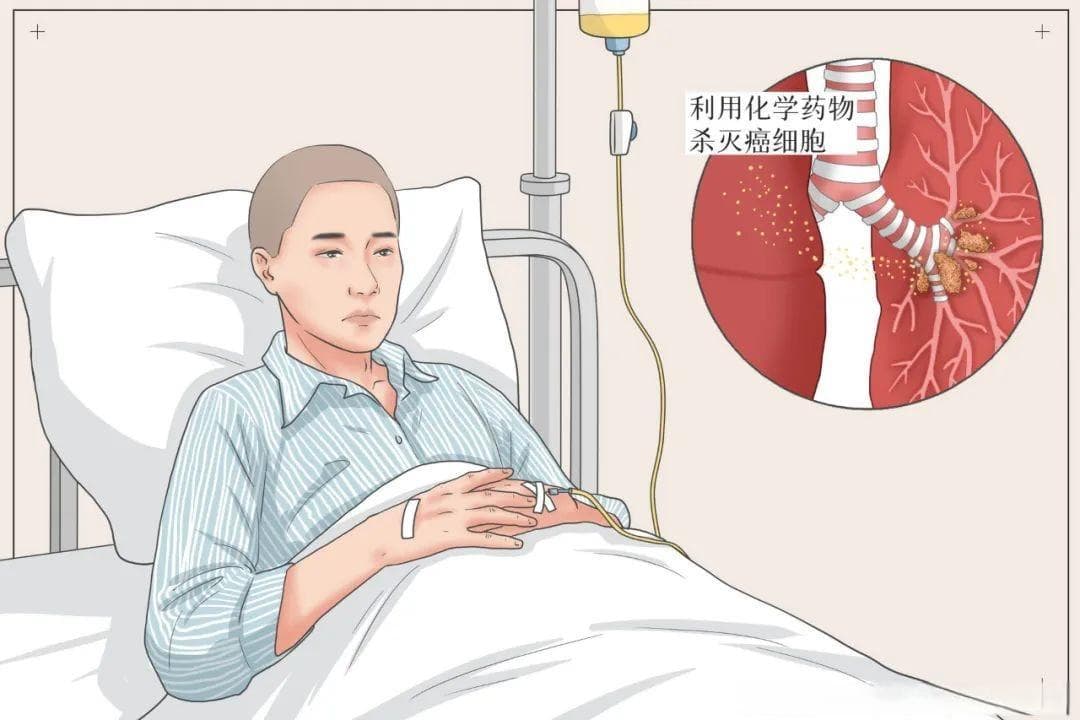 化疗时，恶心呕吐怎么办？