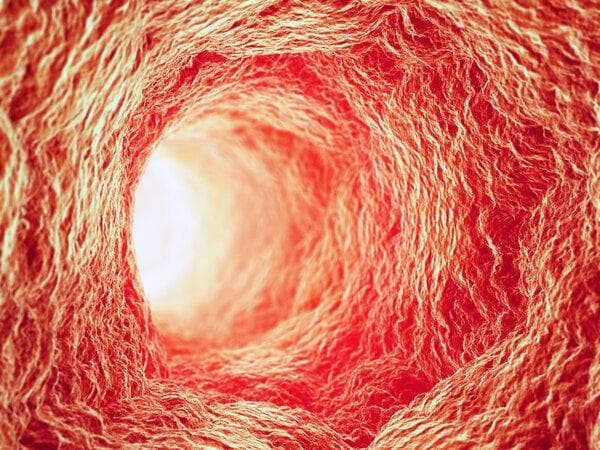血管纤细是什么意思？原因、检查与治疗方法全解析