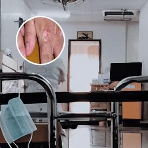 白点净的成分及用法：与人类白癜风治疗无关