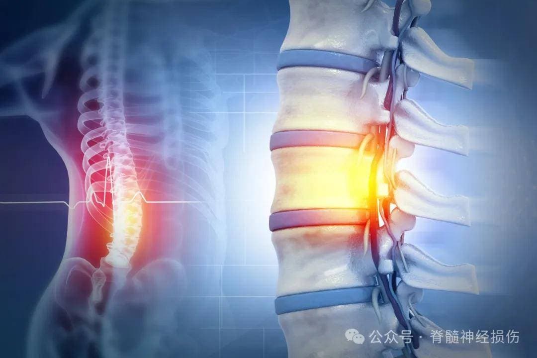 脊髓损伤后必然伴随疼痛吗？揭秘脊髓损伤的常见症状