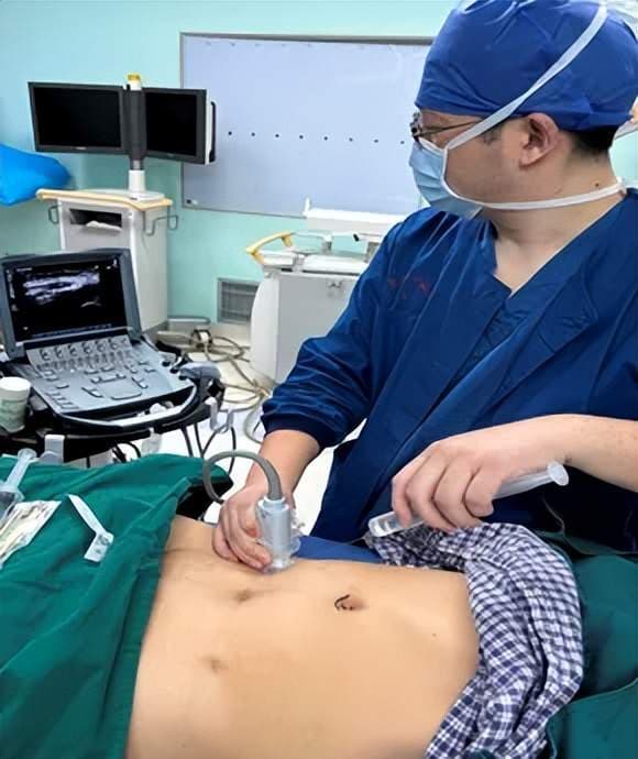 超声引导下髂筋膜阻滞：下肢骨折术后镇痛的新选择
