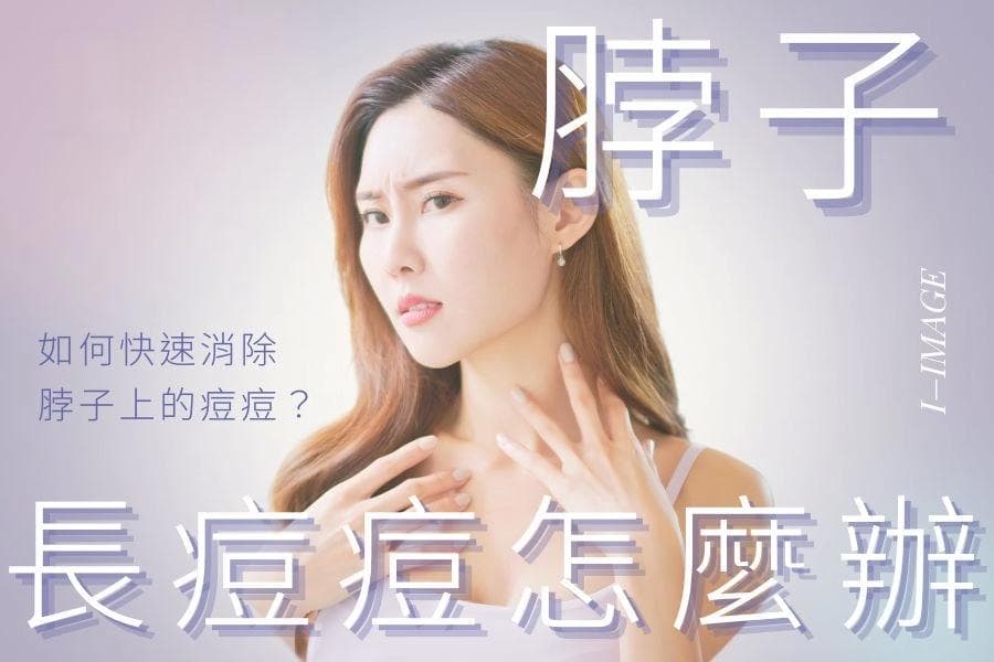 脖子长痘痘怎么办？原因分析与解决方案全攻略