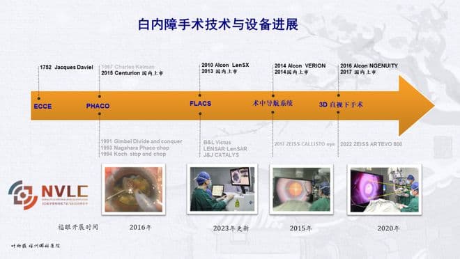 让白内障手术更加安全精准！福州眼科教授深度解析“智能手术平台”