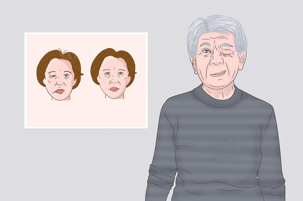 梅杰综合症是什么病，能治愈吗