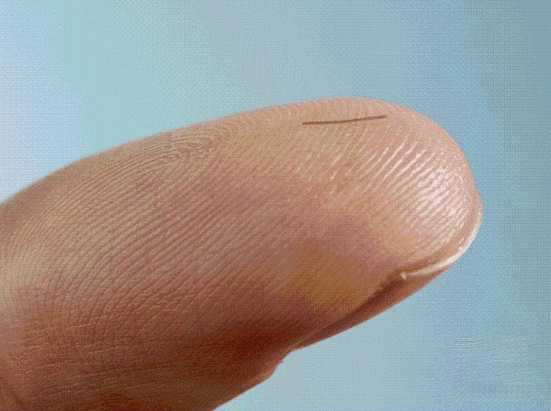 视力很好但青光眼晚期？眼科专家建议40岁体检要查眼压