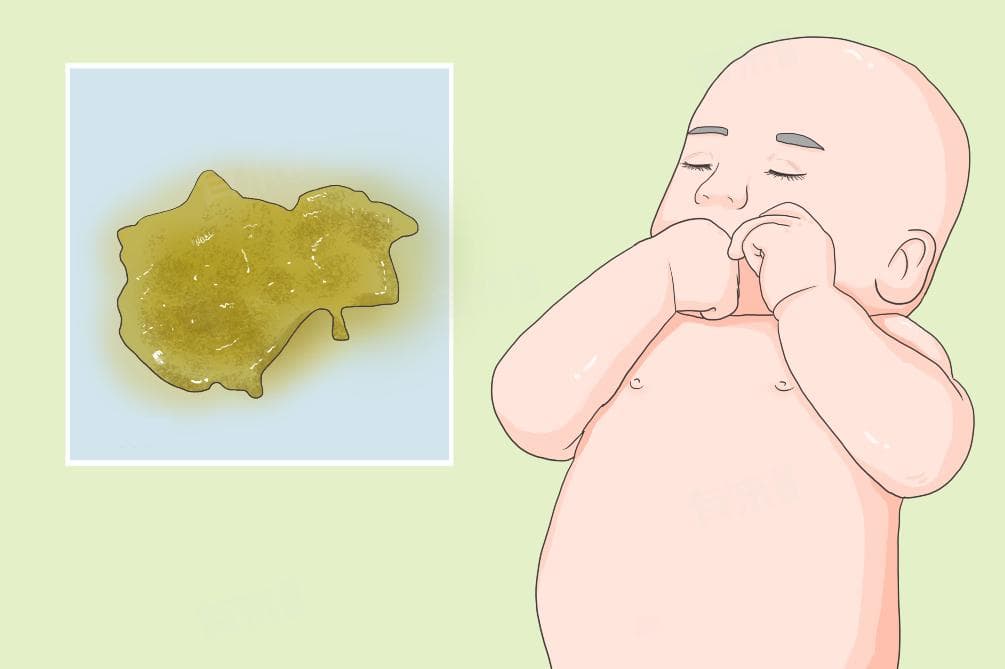 拉绿粑粑：可能的原因及应对方法