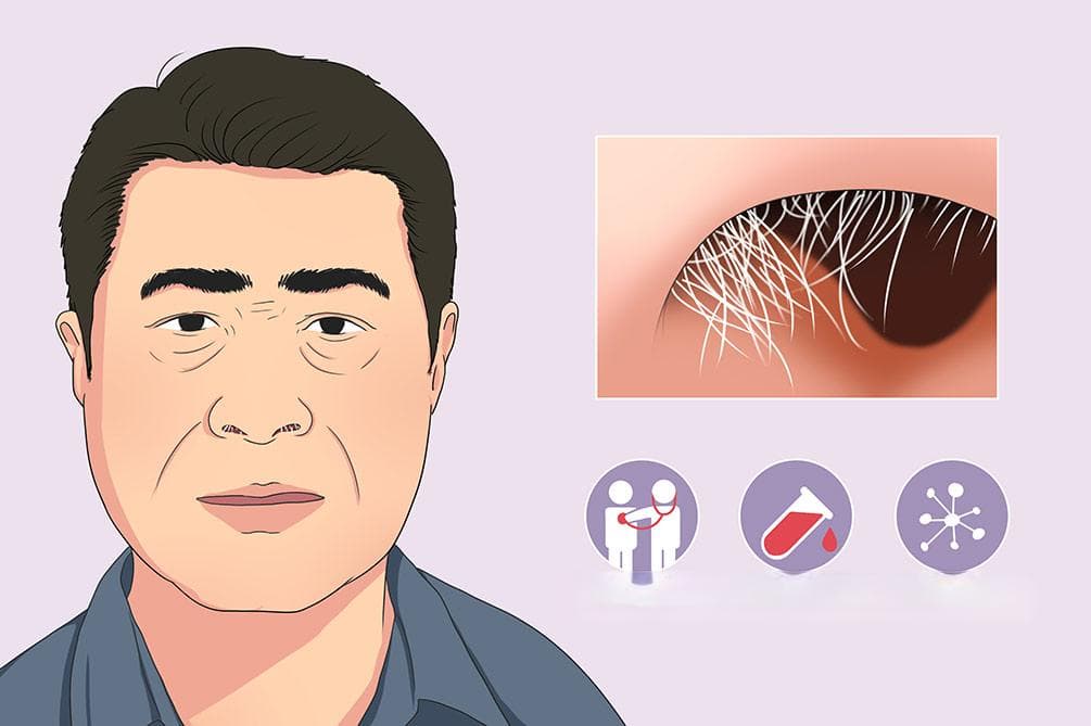 鼻毛变白：原因、症状与治疗全解析