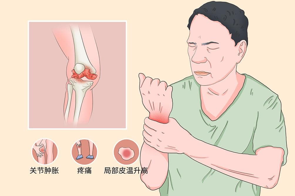 感染性关节炎