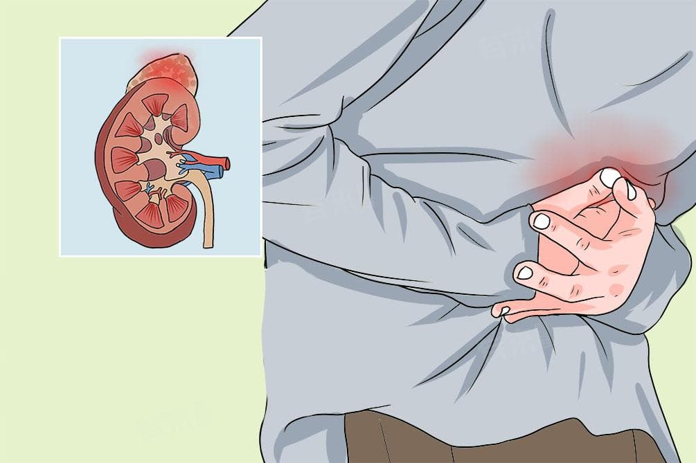 左侧肾上腺增粗是癌吗