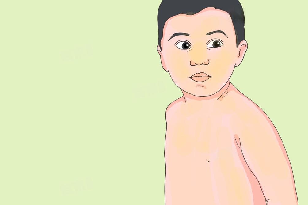 贫血是病还是营养不良