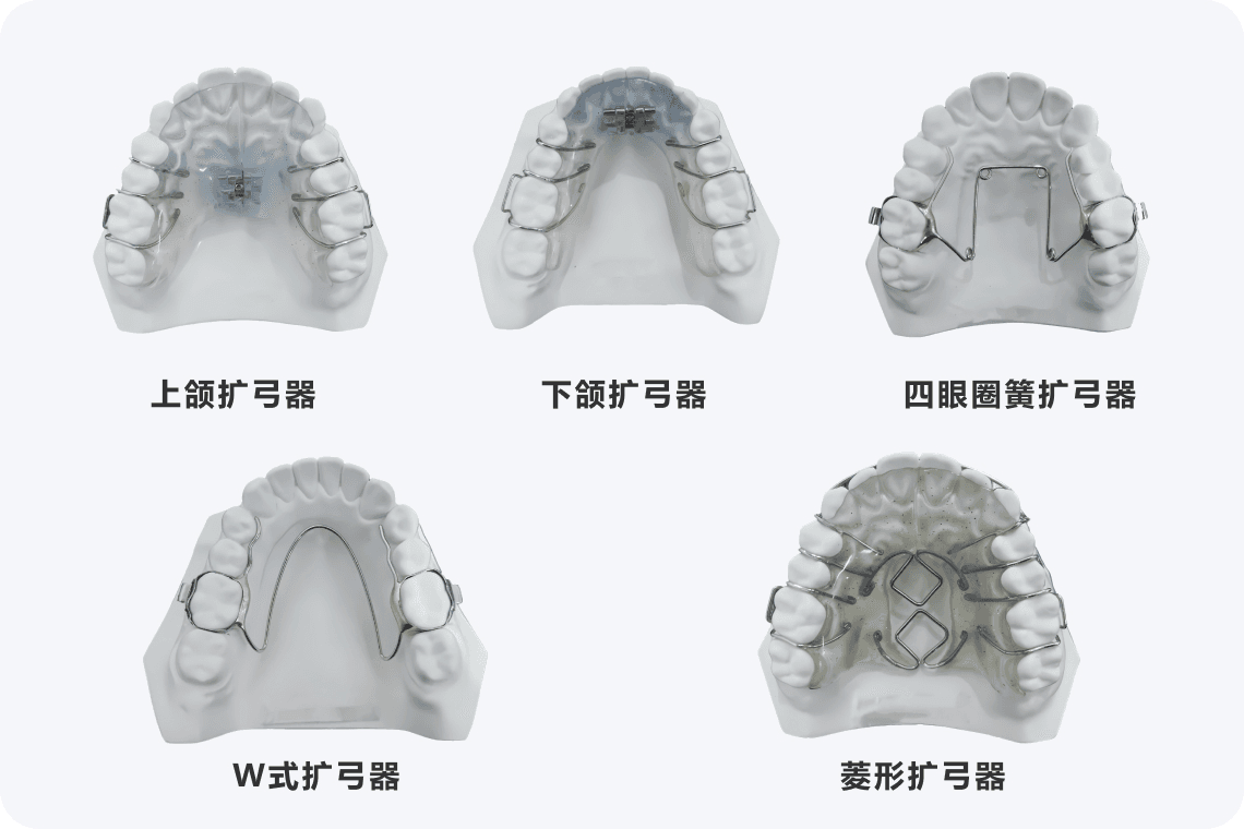 牙齿扩弓器的利弊