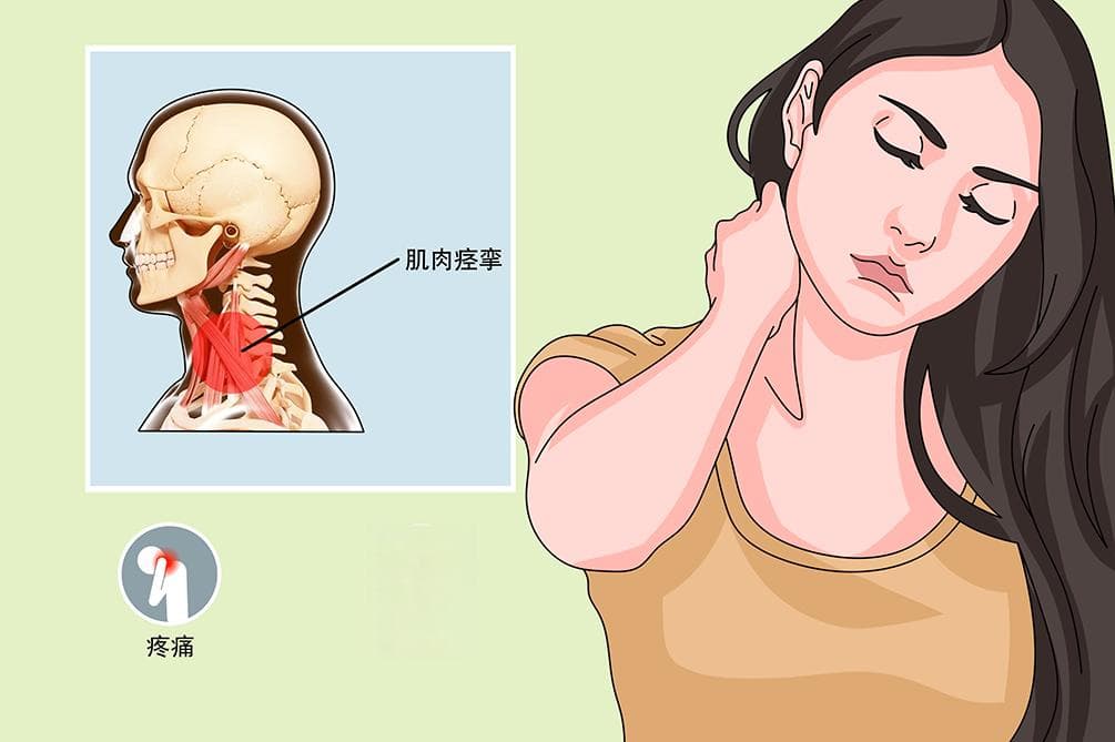 颈项强直：症状、病因、诊断与治疗全解析