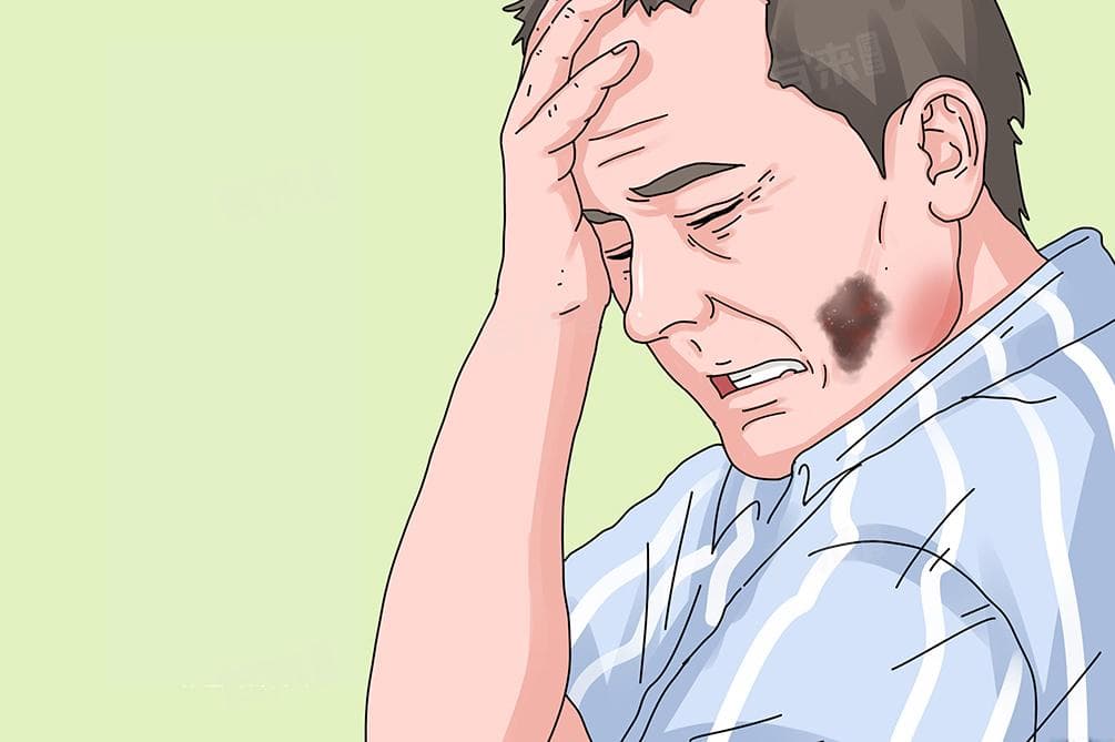 脸上有胎记怎么能去掉