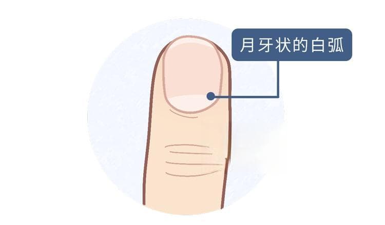 为什么有人指甲上有月牙，有的没有？有竖纹是怎么回事？