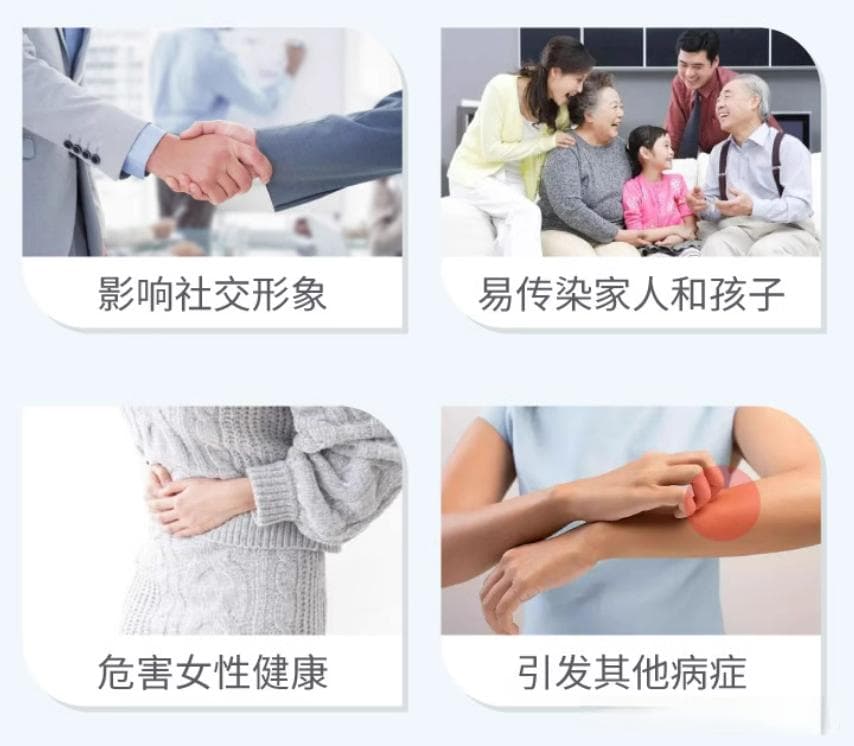 【原】灰指甲的治疗，看这一篇就够了！（附中外文献）