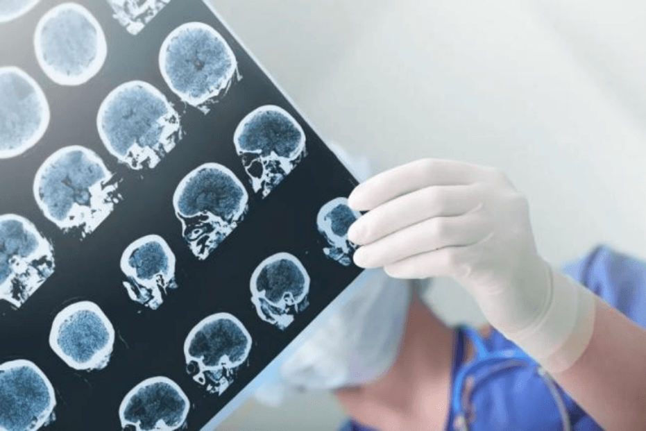 “医”探究竟 | 骨科检查X光片、CT、核磁共振到底有什么区别？