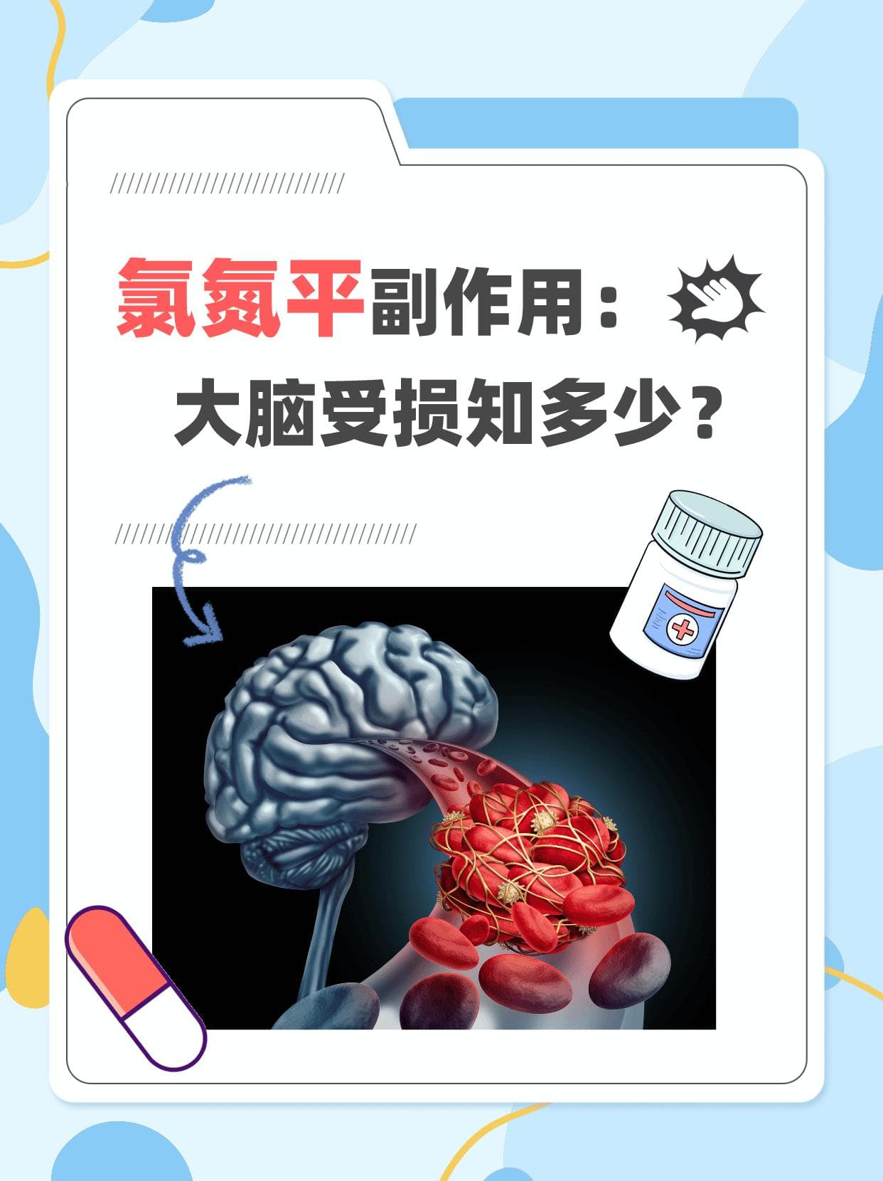 氯氮平副作用：大脑受损知多少？