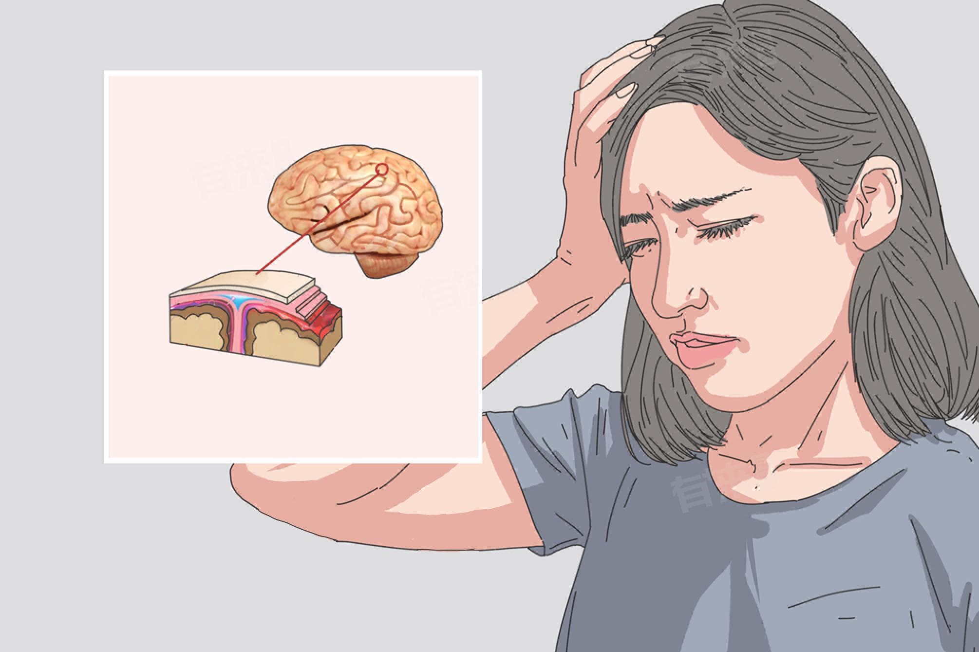 脑膜刺激征阳性的临床意义