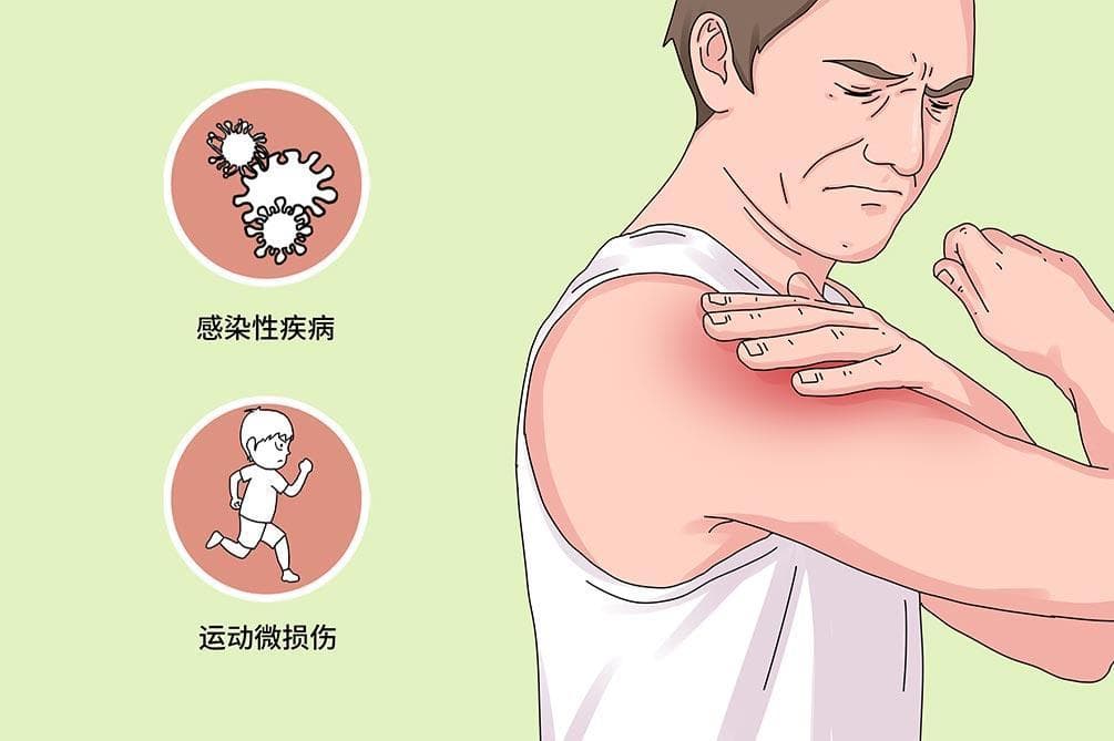 肌肉拉伤挂什么科？一文详解五大科室的诊疗特点
