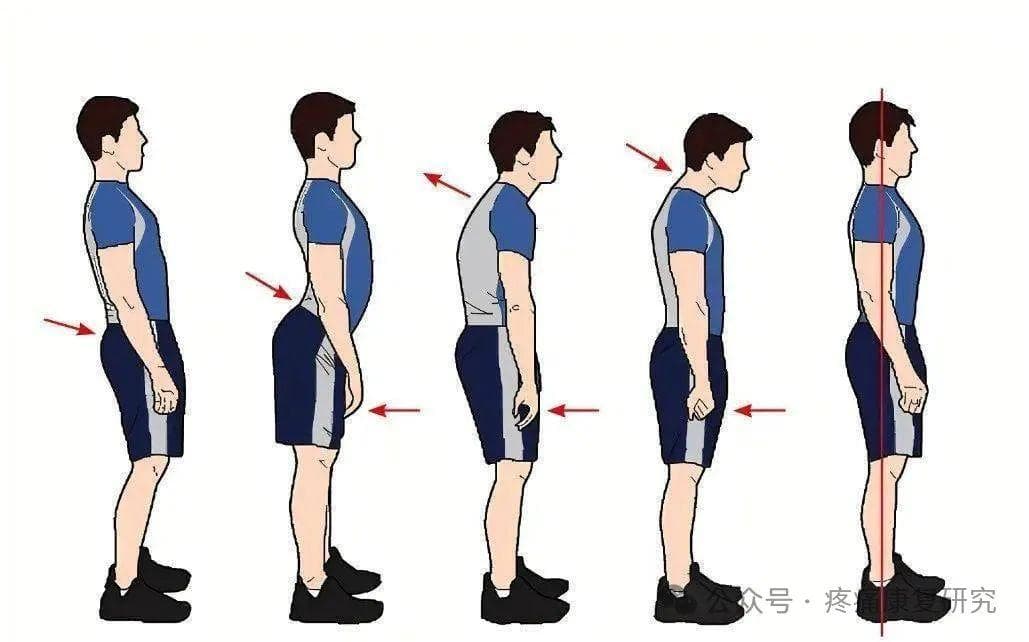 肌肉失衡模式的经典动作评估与分析