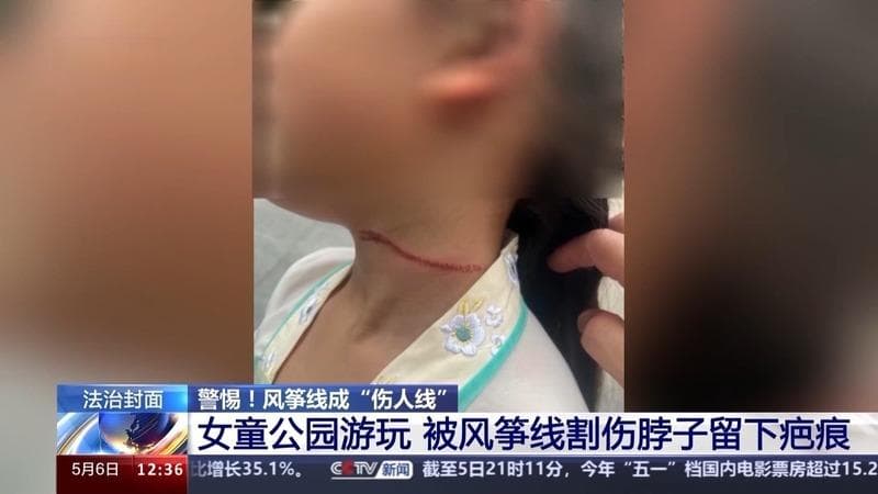 风筝线何以成“隐形刀”？平安放飞有讲究→