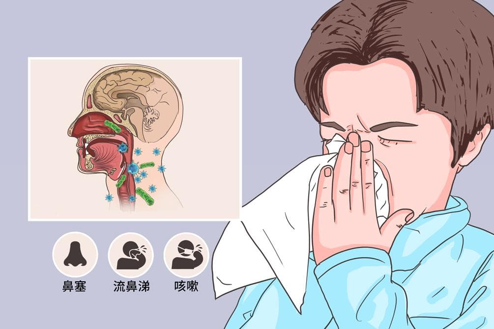 黄鼻涕是什么类型的感冒