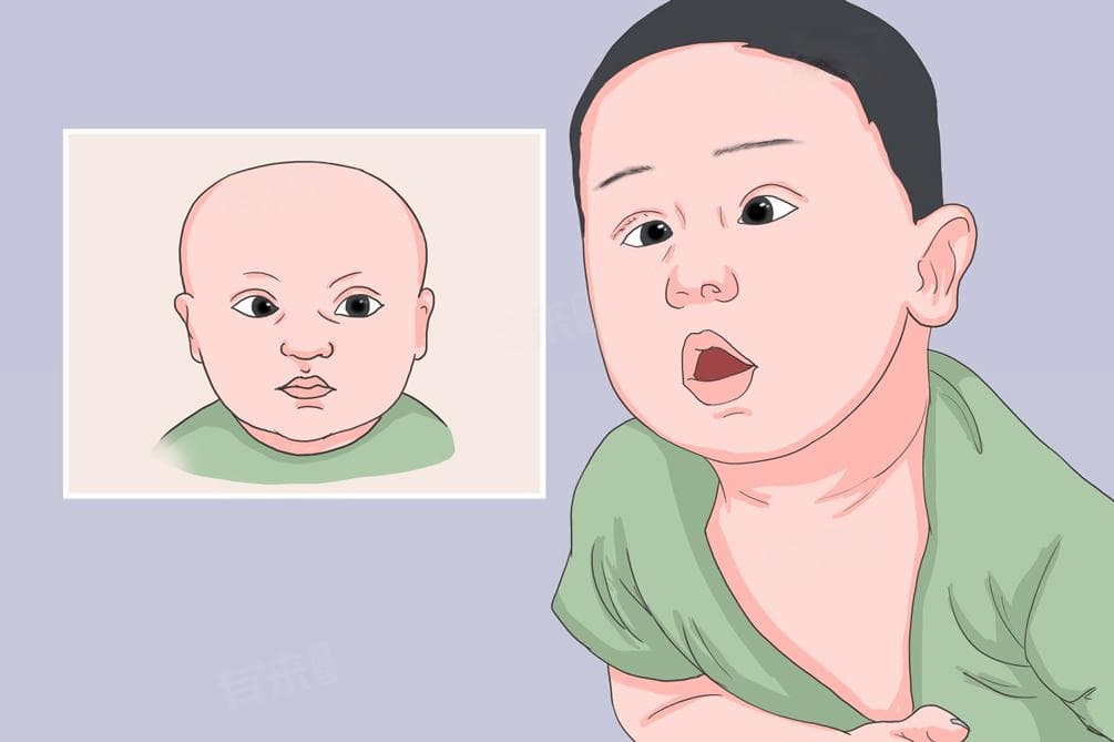 斗鸡眼怎么调整回来