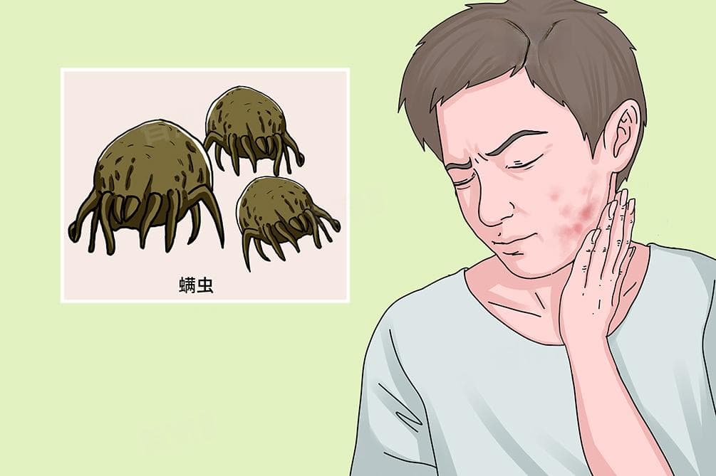 杀螨虫最有效的土办法