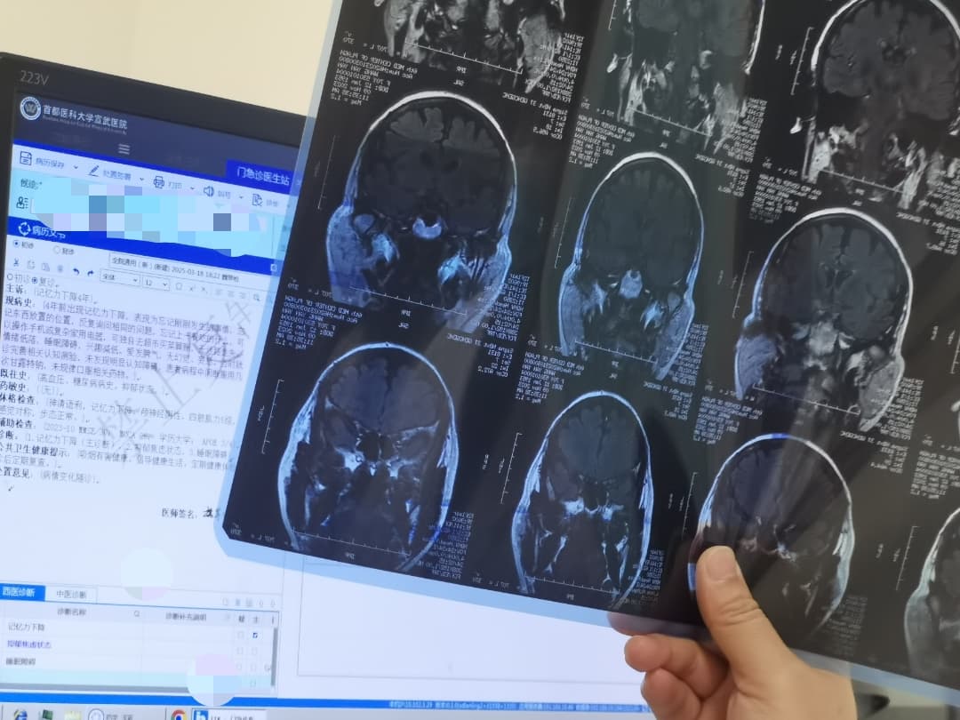 我们的记忆力有救吗？探访记忆门诊