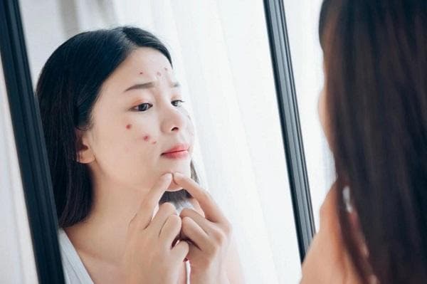 痘痘长在不同部位是反映身体内不同器官的问题吗？