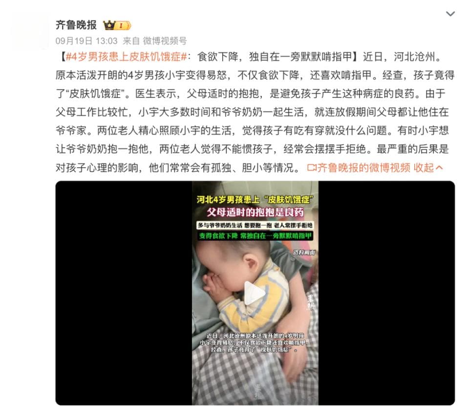 孩子患上“皮肤饥渴症”，父母经常抱抱才能好？