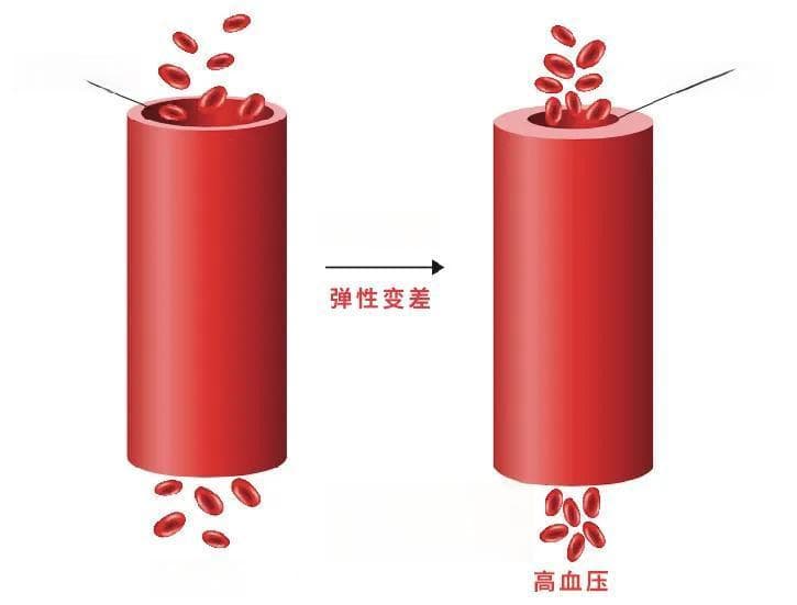 芹菜、木耳不降血压，真正降血压的只有一个