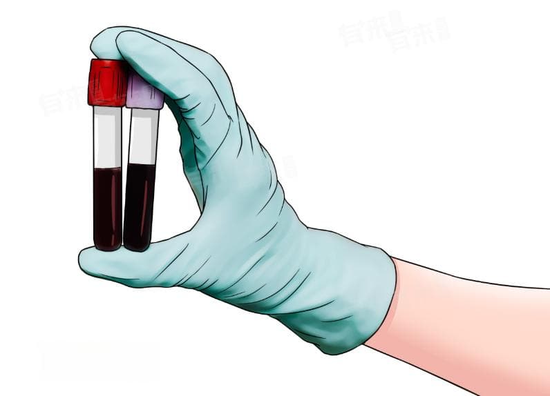 游离三碘甲状腺原氨酸偏高是什么意思