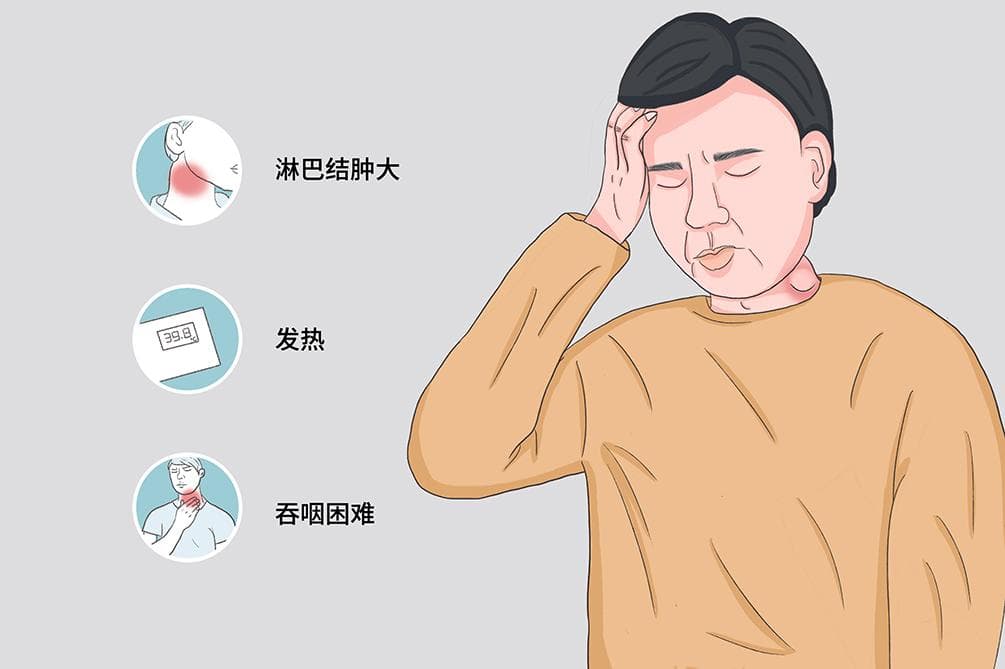 套细胞淋巴瘤