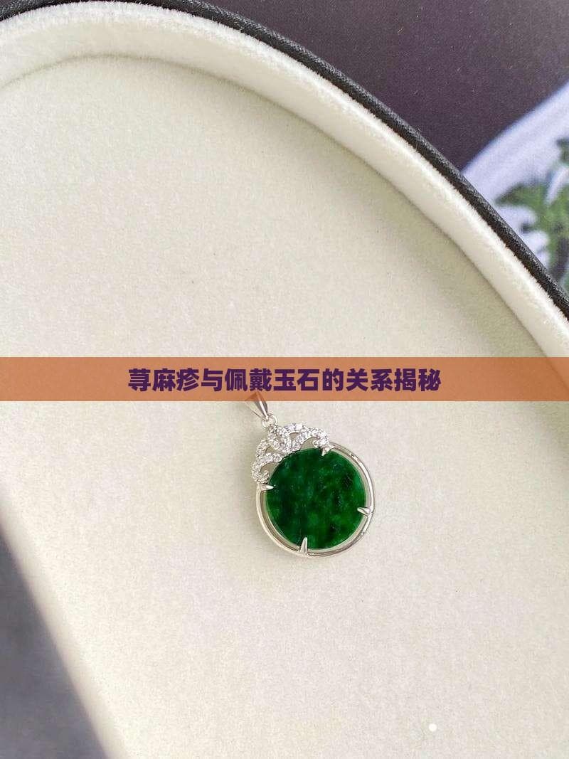 医学研究：玉石不是荨麻疹的直接诱因，但需警惕过敏反应