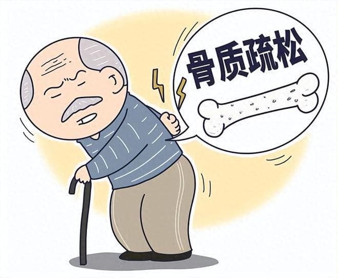女性早期做好骨质疏松预防，出现4类症状要注意，及时就医筛查