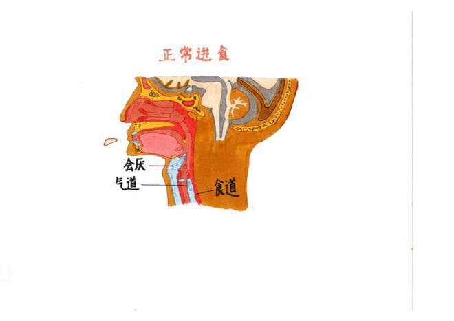 科普｜吞咽障碍不慌张 日常饮食有妙招