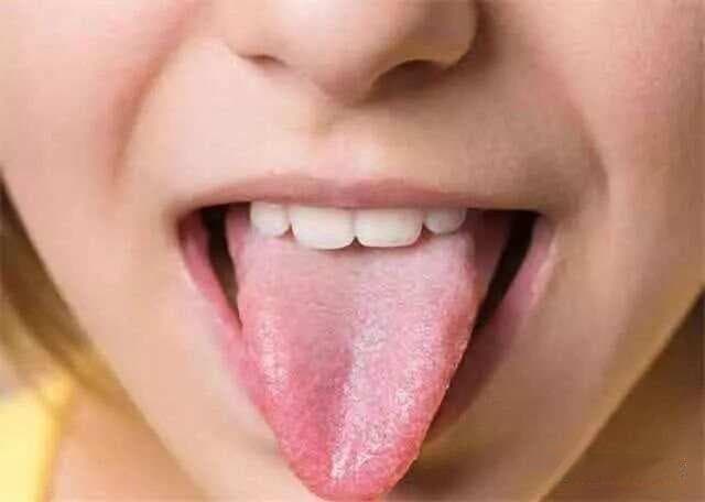 珍藏！史上最全22种高清舌诊图解大全，观舌识病，一看就懂！