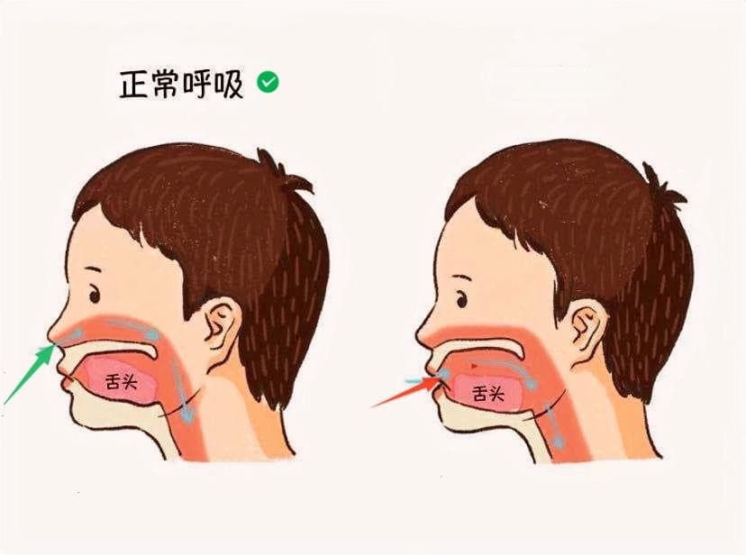 “口呼吸” 轻松应对不焦虑
